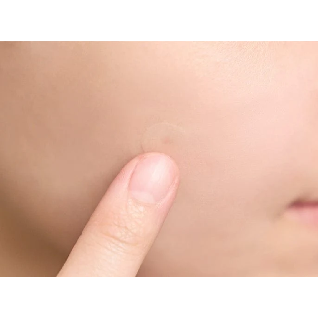 SKIN1004 Spot Patch Ultra-thin Patches for Imperfections