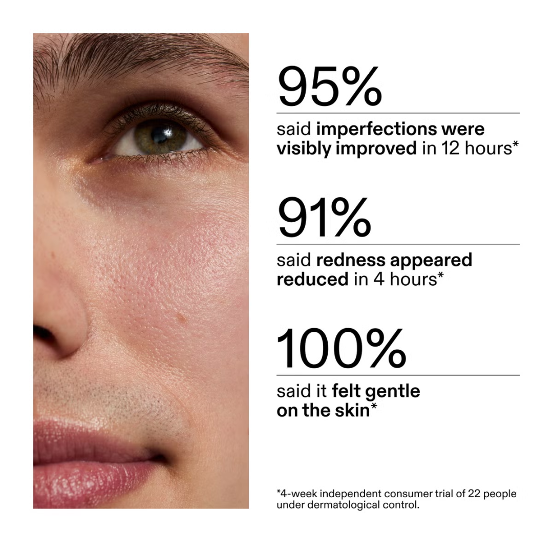 The INKEY List Succinic Acid Treatment